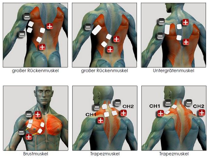 Trapezius